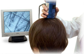 Analisi del cuoio capelluto