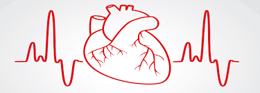 ECG